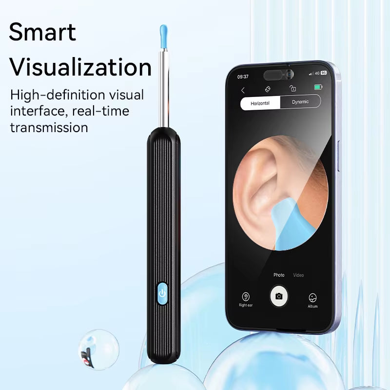 Wireless Ear Wax Removal System with Endoscopic Camera and Luminous Cleaning Tools for Safe Ear Care